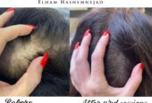 SCALP BY SHAY
