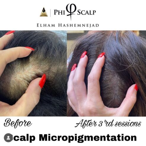 SCALP BY SHAY