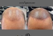 SCALP BY SHAY
