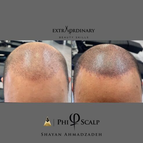 SCALP BY SHAY